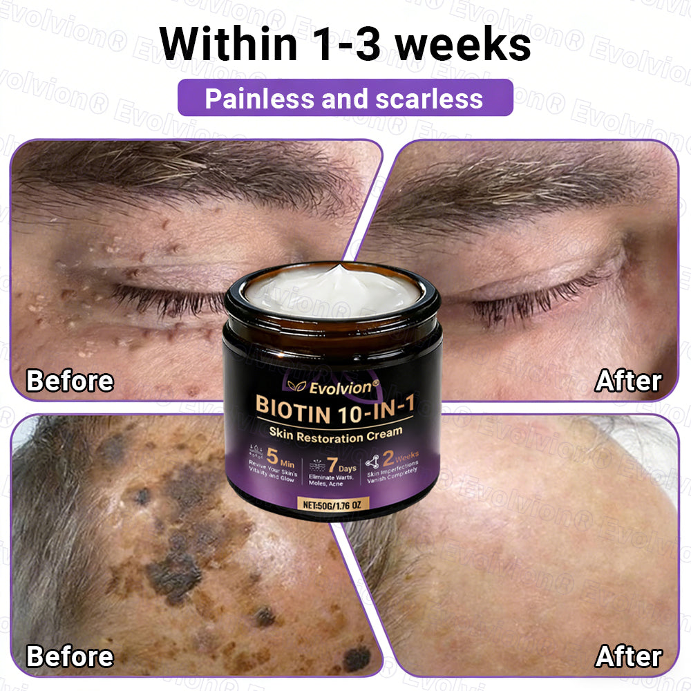 Made and Shipped from Canada ✨Evolvion® Biotin 10-in-1 Skin Restoration Cream 🔥🔥