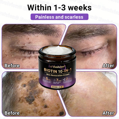 Made and Shipped from Canada ✨Evolvion® Biotin 10-in-1 Skin Restoration Cream 🔥🔥