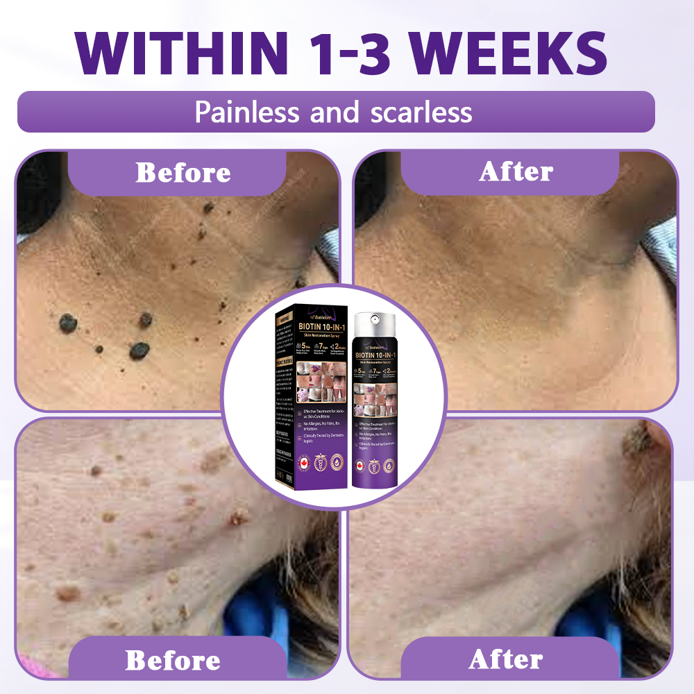 Made and Shipped from Canada✨Evolvion® Biotin 10-in-1 Skin Restoration Spray