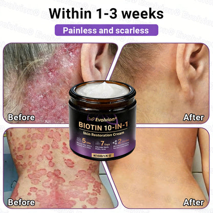 Made and Shipped from Canada ✨Evolvion® Biotin 10-in-1 Skin Restoration Cream 🔥🔥