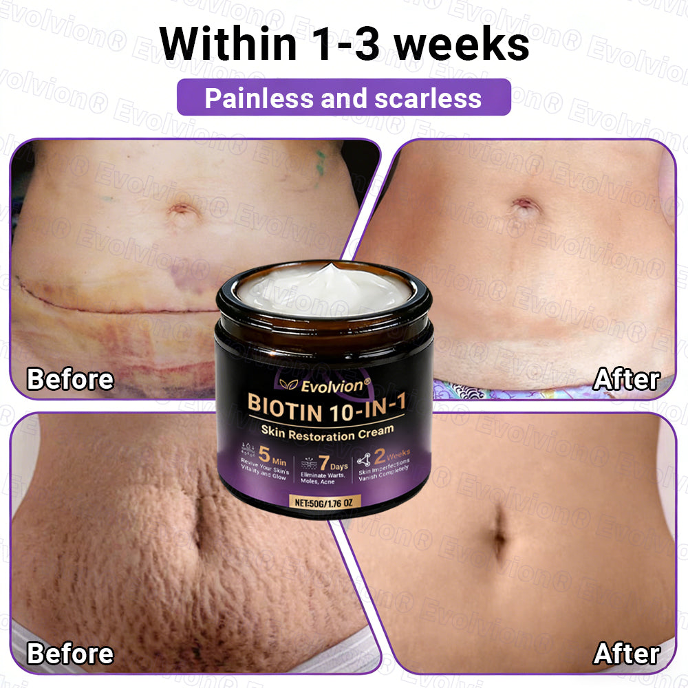 Made and Shipped from Canada ✨Evolvion® Biotin 10-in-1 Skin Restoration Cream 🔥🔥