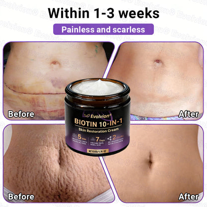 Made and Shipped from Canada ✨Evolvion® Biotin 10-in-1 Skin Restoration Cream 🔥🔥