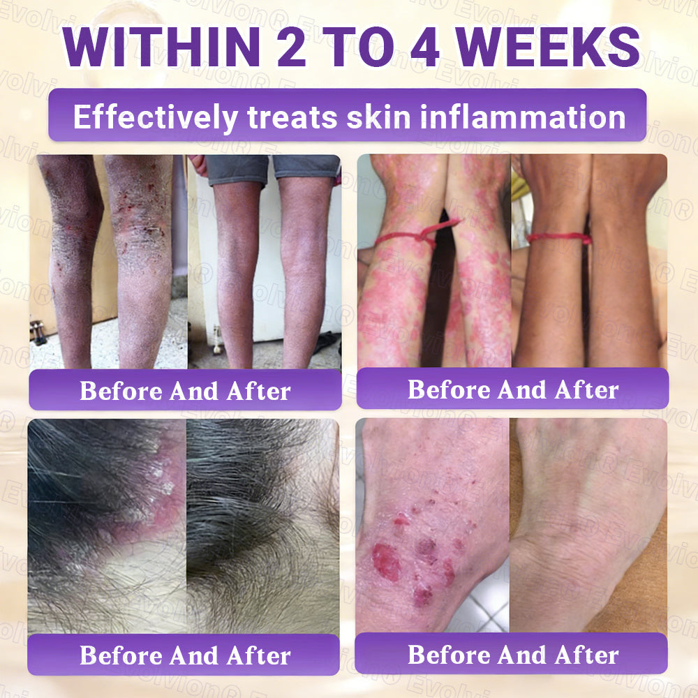 Made and Shipped from Canada ✨Evolvion® Biotin 10-in-1 Skin Restoration Cream 🔥🔥