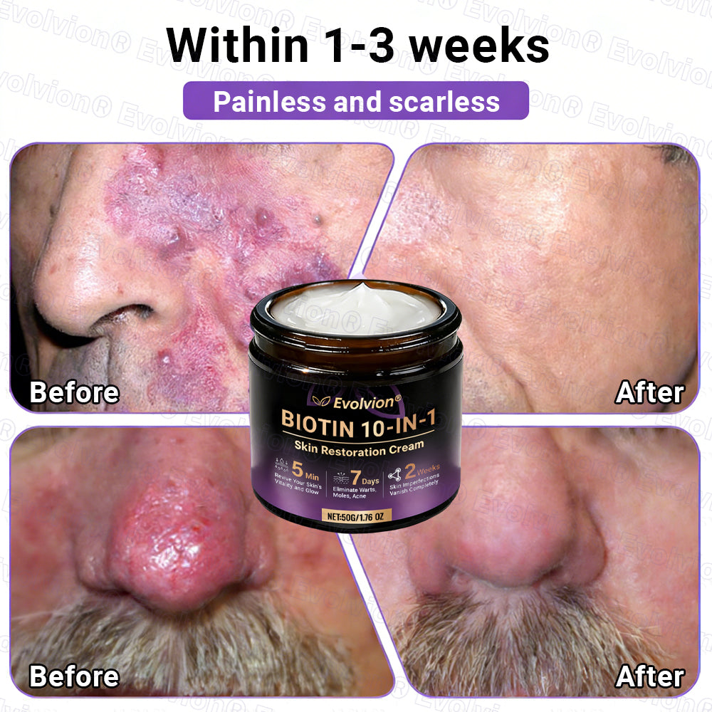 Made and Shipped from Canada ✨Evolvion® Biotin 10-in-1 Skin Restoration Cream 🔥🔥