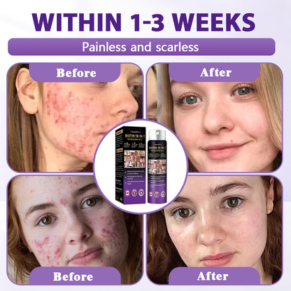 Made and Shipped from Canada✨Evolvion® Biotin 10-in-1 Skin Restoration Spray