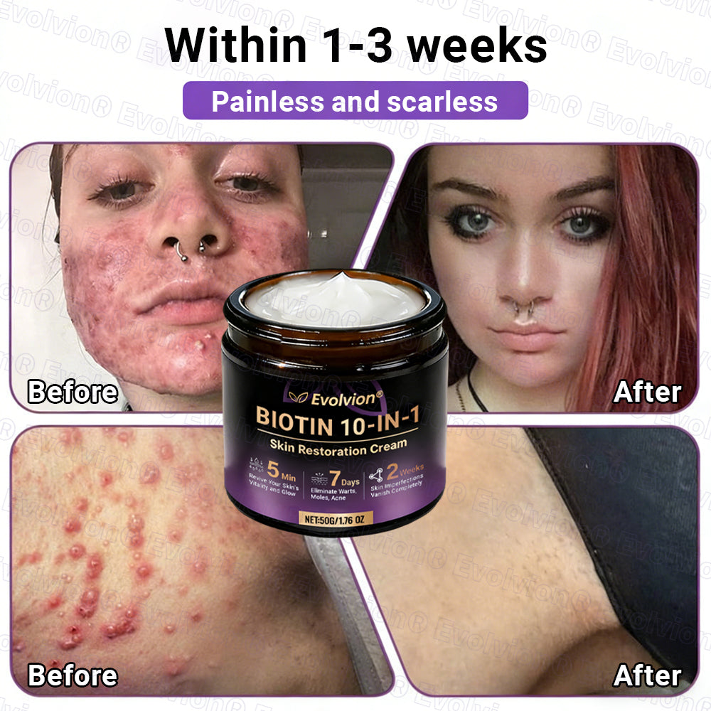 Made and Shipped from Canada ✨Evolvion® Biotin 10-in-1 Skin Restoration Cream 🔥🔥